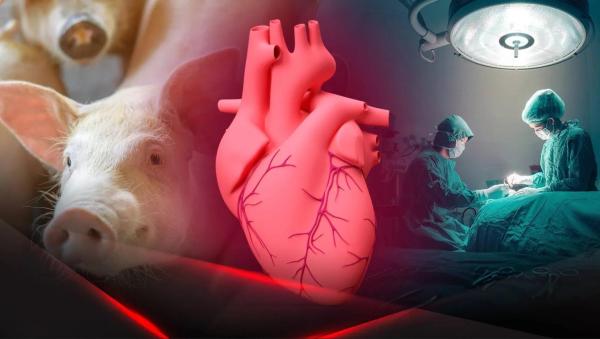Как учёные преодолевают иммунные барьеры при пересадке органов от животных человеку
