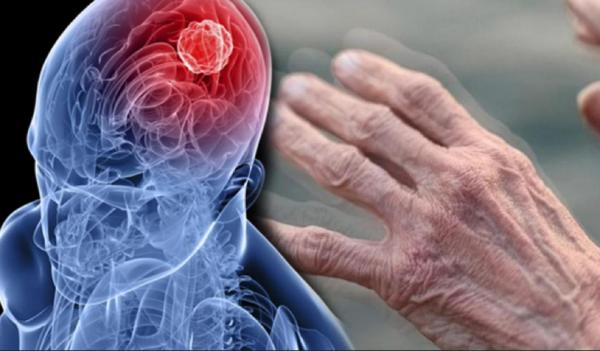 Ученые сто лет ищут причины неизлечимой болезни